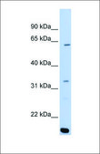 Anti-ARID5A (ab2) antibody produced in rabbit affinity isolated antibody