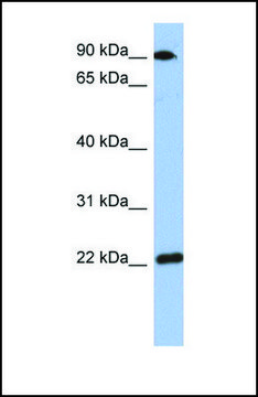 Anti-TMED10 antibody produced in rabbit affinity isolated antibody