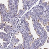 Anti-FAM166B antibody produced in rabbit Prestige Antibodies® Powered by Atlas Antibodies, affinity isolated antibody, buffered aqueous glycerol solution