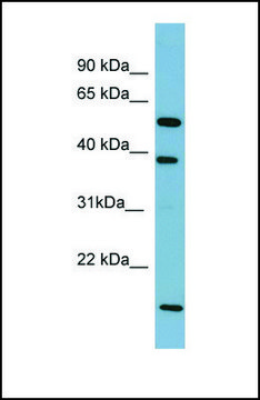 Anti-SLC10A1 antibody produced in rabbit affinity isolated antibody