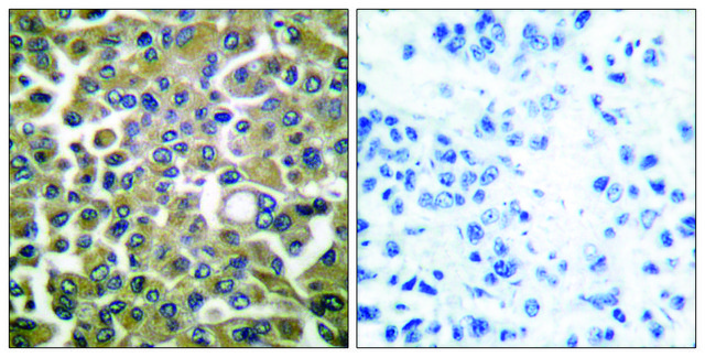 Anti-Keratin 16 antibody produced in rabbit affinity isolated antibody