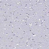 Anti-S100A11 antibody produced in rabbit Prestige Antibodies® Powered by Atlas Antibodies, affinity isolated antibody, buffered aqueous glycerol solution