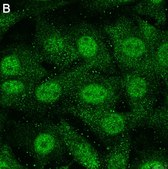 Anti-Treslin Antibody, clone 5L19 ZooMAb® Rabbit Monoclonal recombinant, expressed in HEK 293 cells