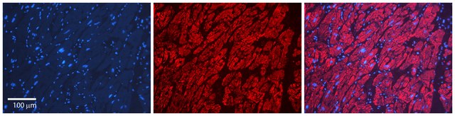 Anti-LSM1 antibody produced in rabbit affinity isolated antibody