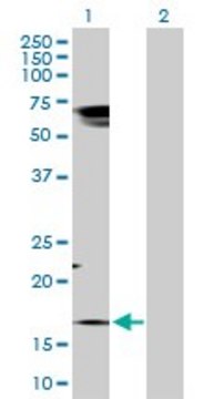 Anti-TAC1 antibody produced in rabbit purified immunoglobulin, buffered aqueous solution