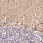 Anti-PPP1R1B antibody produced in rabbit Prestige Antibodies® Powered by Atlas Antibodies, affinity isolated antibody, buffered aqueous glycerol solution