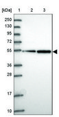 Anti-TUBB8 antibody produced in rabbit Prestige Antibodies® Powered by Atlas Antibodies, affinity isolated antibody, buffered aqueous glycerol solution