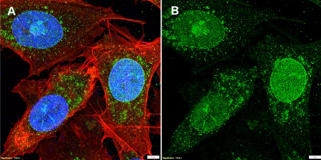 Anti-CXCL1/GRO&#945; Antibody, clone 2J19 ZooMAb&#174; Rabbit Monoclonal recombinant, expressed in HEK 293 cells