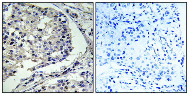 Anti-MLK1 antibody produced in rabbit affinity isolated antibody