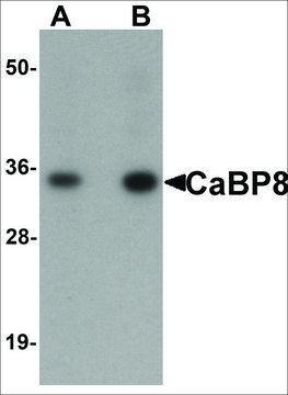 Anti-CaBP8 antibody produced in rabbit affinity isolated antibody, buffered aqueous solution