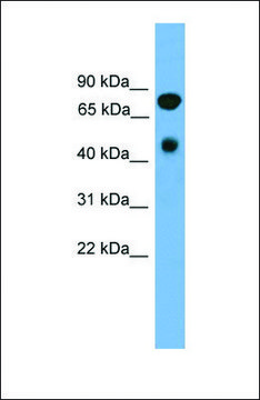 Anti-RIPK4, (N-terminal) antibody produced in rabbit affinity isolated antibody