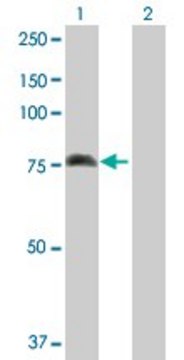 Anti-ALOX15 antibody produced in rabbit purified immunoglobulin, buffered aqueous solution