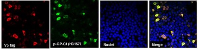 Anti-C9ORF72/C9RANT (GPsense-CT) serum, from rabbit