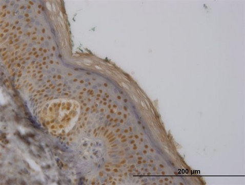 Monoclonal Anti-FBXO11 antibody produced in mouse clone 4C12, purified immunoglobulin, buffered aqueous solution