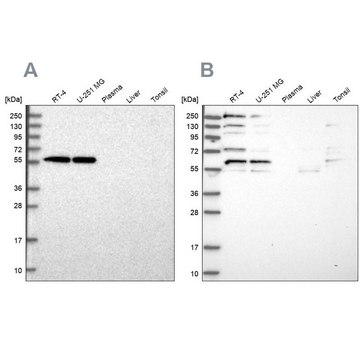 Anti-SAAL1 antibody produced in rabbit Prestige Antibodies&#174; Powered by Atlas Antibodies, affinity isolated antibody