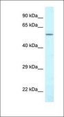 Anti-CTPS2 antibody produced in rabbit affinity isolated antibody