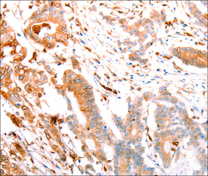 Anti-ABCA4 antibody produced in rabbit affinity isolated antibody