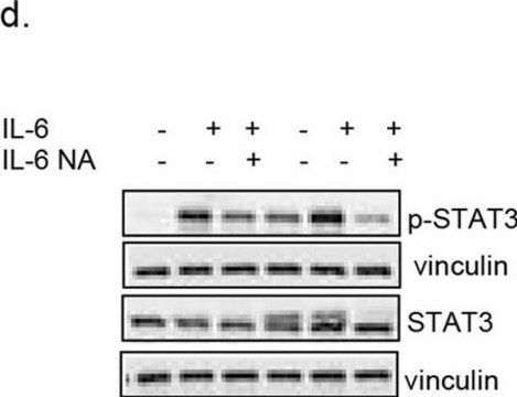 Anti-Vinculin Antibody, clone V284 clone V284, Upstate&#174;, from mouse