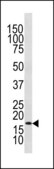 ANTI-LC3 (APG8C) (N-TERM) antibody produced in rabbit IgG fraction of antiserum, buffered aqueous solution
