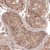 Monoclonal Anti-LAPTM4B antibody produced in mouse Prestige Antibodies® Powered by Atlas Antibodies, clone CL5287, purified immunoglobulin, buffered aqueous glycerol solution