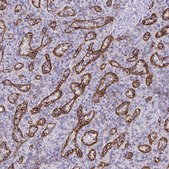 Anti-PITPNM3 antibody produced in rabbit Prestige Antibodies® Powered by Atlas Antibodies, affinity isolated antibody, buffered aqueous glycerol solution