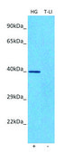 Anti-EME2 antibody produced in rabbit affinity isolated antibody