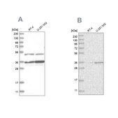 Anti-PDHB antibody produced in rabbit Prestige Antibodies® Powered by Atlas Antibodies, affinity isolated antibody, buffered aqueous glycerol solution