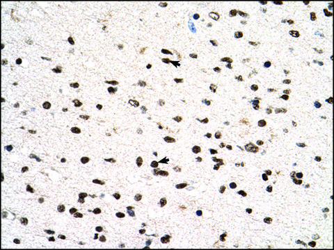 Anti-PGS1 (AB1) antibody produced in rabbit affinity isolated antibody