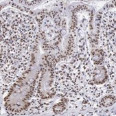 Anti-SNRPD3 antibody produced in rabbit Prestige Antibodies® Powered by Atlas Antibodies, affinity isolated antibody, buffered aqueous glycerol solution