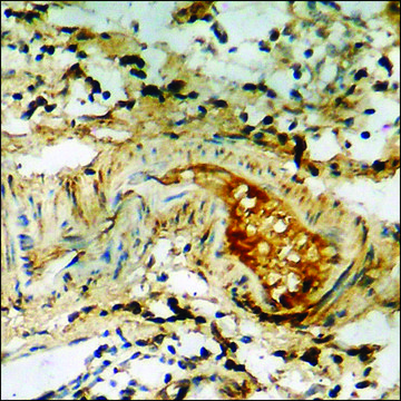 Anti-phospho-DAPK2 (pSer318) antibody produced in rabbit affinity isolated antibody