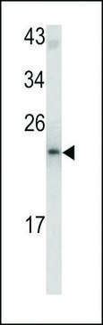 ANTI-MCT-1(N-TERMINAL) antibody produced in rabbit purified immunoglobulin, buffered aqueous solution