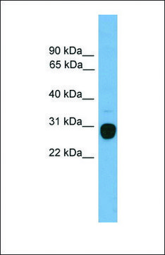 Anti-TREM2 antibody produced in rabbit affinity isolated antibody, lyophilized powder