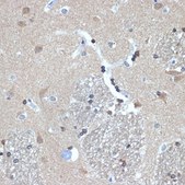 Anti-RanBP9 antibody produced in rabbit