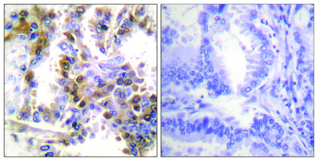 Anti-4E-BP1 antibody produced in rabbit affinity isolated antibody