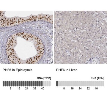 抗-PHF6 兔抗 affinity isolated antibody, buffered aqueous glycerol solution