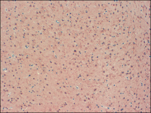 Monoclonal Anti-KCNB2 antibody produced in mouse clone S37-89, 1&#160;mg/mL, purified immunoglobulin