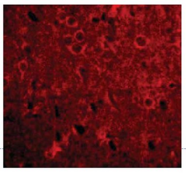 Anti-GPAT-1 Antibody from rabbit, purified by affinity chromatography