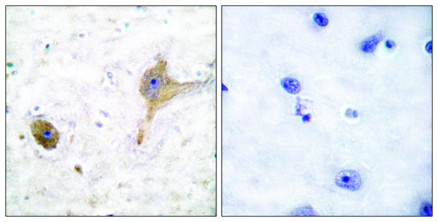 Anti-GABA-B Receptor antibody produced in rabbit affinity isolated antibody