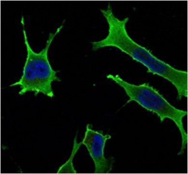 Anti-Rab10 Antibody, clone 4E2 ascites fluid, clone 4E2, from mouse