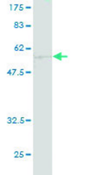 ANTI-CA1 antibody produced in mouse clone 1E11, purified immunoglobulin, buffered aqueous solution