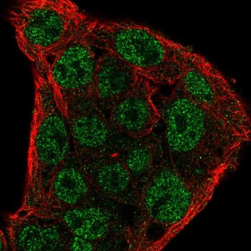 Anti-SOCS1 antibody produced in rabbit Prestige Antibodies&#174; Powered by Atlas Antibodies, affinity isolated antibody