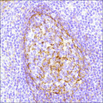 Anti-B7-H3/CD276 antibody, Rabbit monoclonal clone SP206, recombinant, expressed in proprietary host, affinity isolated antibody