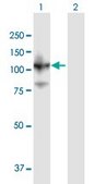 Anti-SART1 antibody produced in mouse purified immunoglobulin, buffered aqueous solution