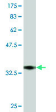 Monoclonal Anti-TRPV5, (N-terminal) antibody produced in mouse clone 6D6, purified immunoglobulin, buffered aqueous solution