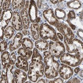 Anti-BCL10 antibody produced in rabbit Prestige Antibodies® Powered by Atlas Antibodies, affinity isolated antibody, buffered aqueous glycerol solution