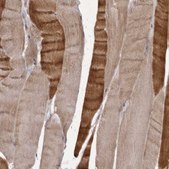 Anti-PNRC1 antibody produced in rabbit Prestige Antibodies® Powered by Atlas Antibodies, affinity isolated antibody, buffered aqueous glycerol solution