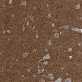 Anti-AMPH antibody produced in rabbit Prestige Antibodies® Powered by Atlas Antibodies, affinity isolated antibody, buffered aqueous glycerol solution, Ab1