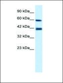 Anti-TRIM31 antibody produced in rabbit affinity isolated antibody