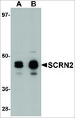 Anti-SCRN2 antibody produced in rabbit affinity isolated antibody, buffered aqueous solution