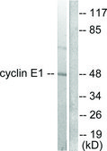 Anti-Cyclin E1 antibody produced in rabbit affinity isolated antibody